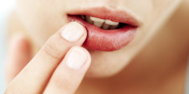 Thói quen liếm môi thường xuyên sẽ gây viêm da, viêm môi, đau rát