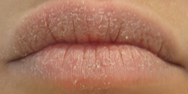Mỗi lần bạn liếm môi sẽ làm môi của bạn sẽ trở nên khô ráp hơn